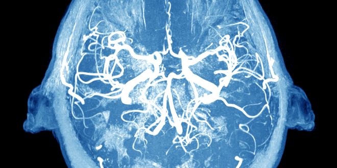 Glial Cell Transplants Alleviate Huntington’s Symptoms and Prolong Life